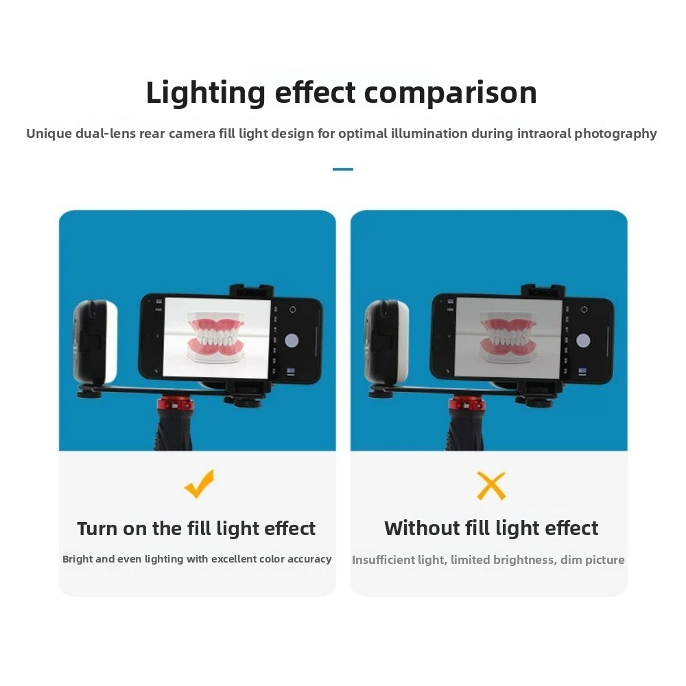 Luce per fotografia dentale, f - Photography Lighting Flash recensione e prezzo