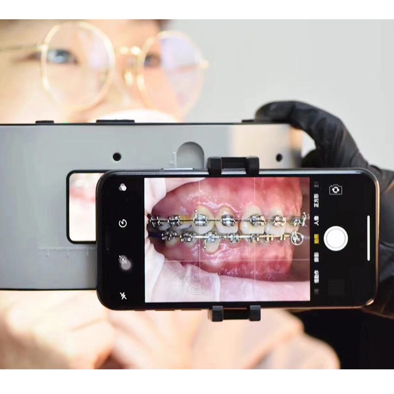 Nuova Lampada Flash Dentale co - Photography Lighting Flash recensione e prezzo